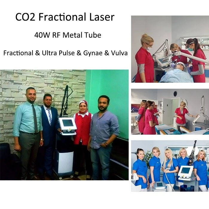 CO2 Fractional Laser Scar Removal Marks Removal Skin Rejuvenatrion Machine